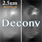 Robust blind GEM algorithm : 蛍光顕微鏡の細胞画像復元