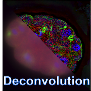 ３次元蛍光顕微鏡画像に対する奥行き・非対称収差に適応的なブラインド画像復元