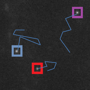 てんかん診断に向けた神経細胞画像におけるγアミノ酪酸受容体の異常運動の検出